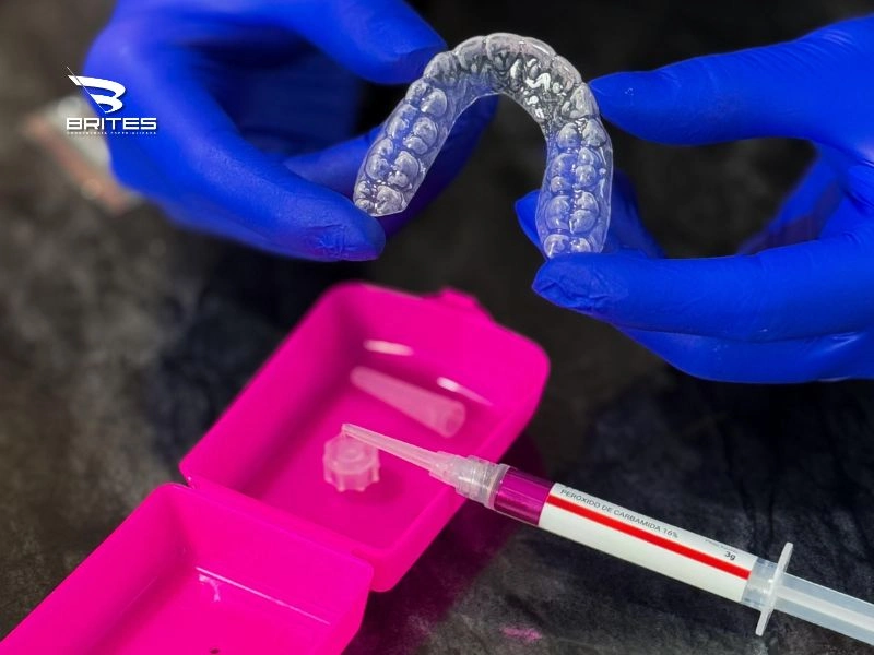 clareamento-dental-clinica-brites (2)