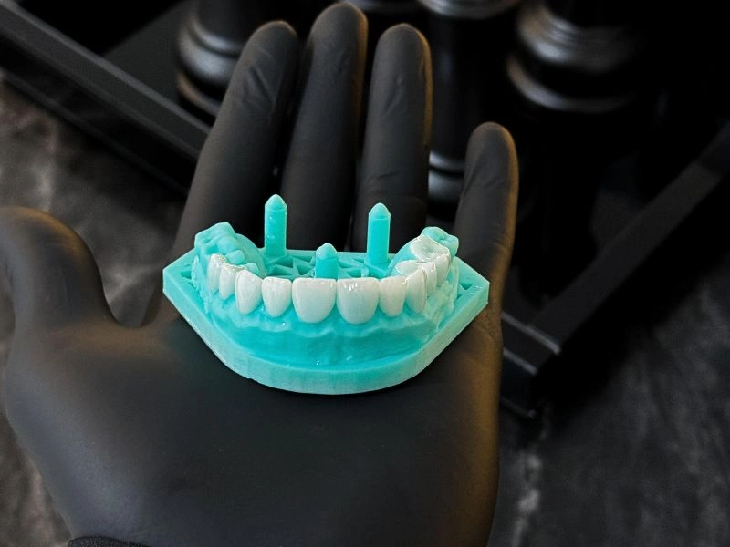 laminados_ceramicos_clinica_brites (1)