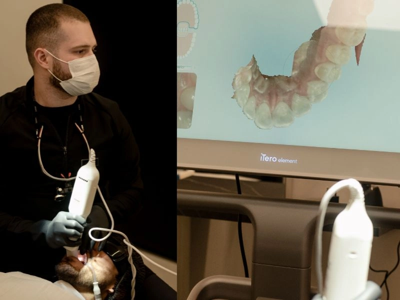 laminados_ceramicos_clinica_brites (2)